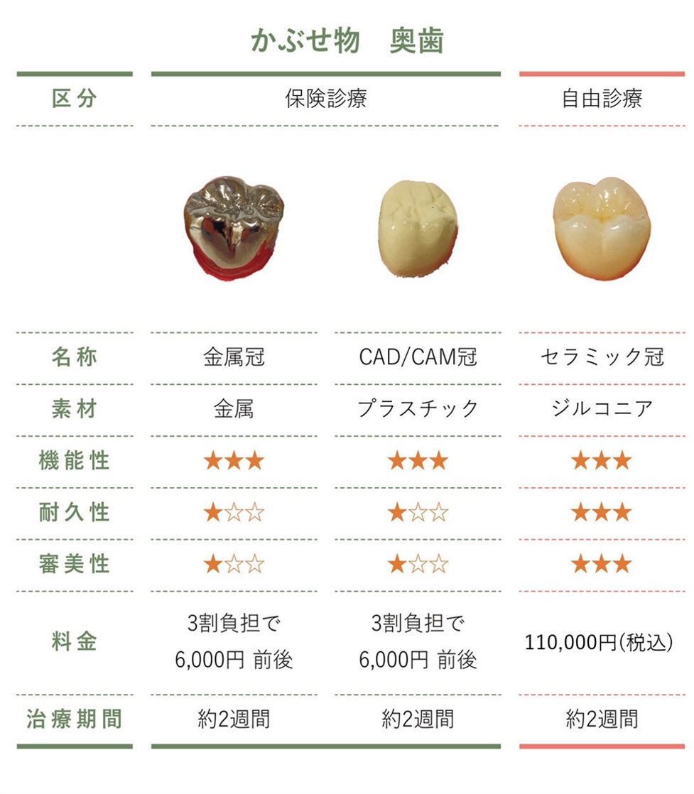 セラミック冠-奥歯260127