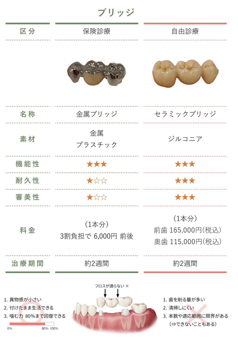 セラミックブリッジ-260127