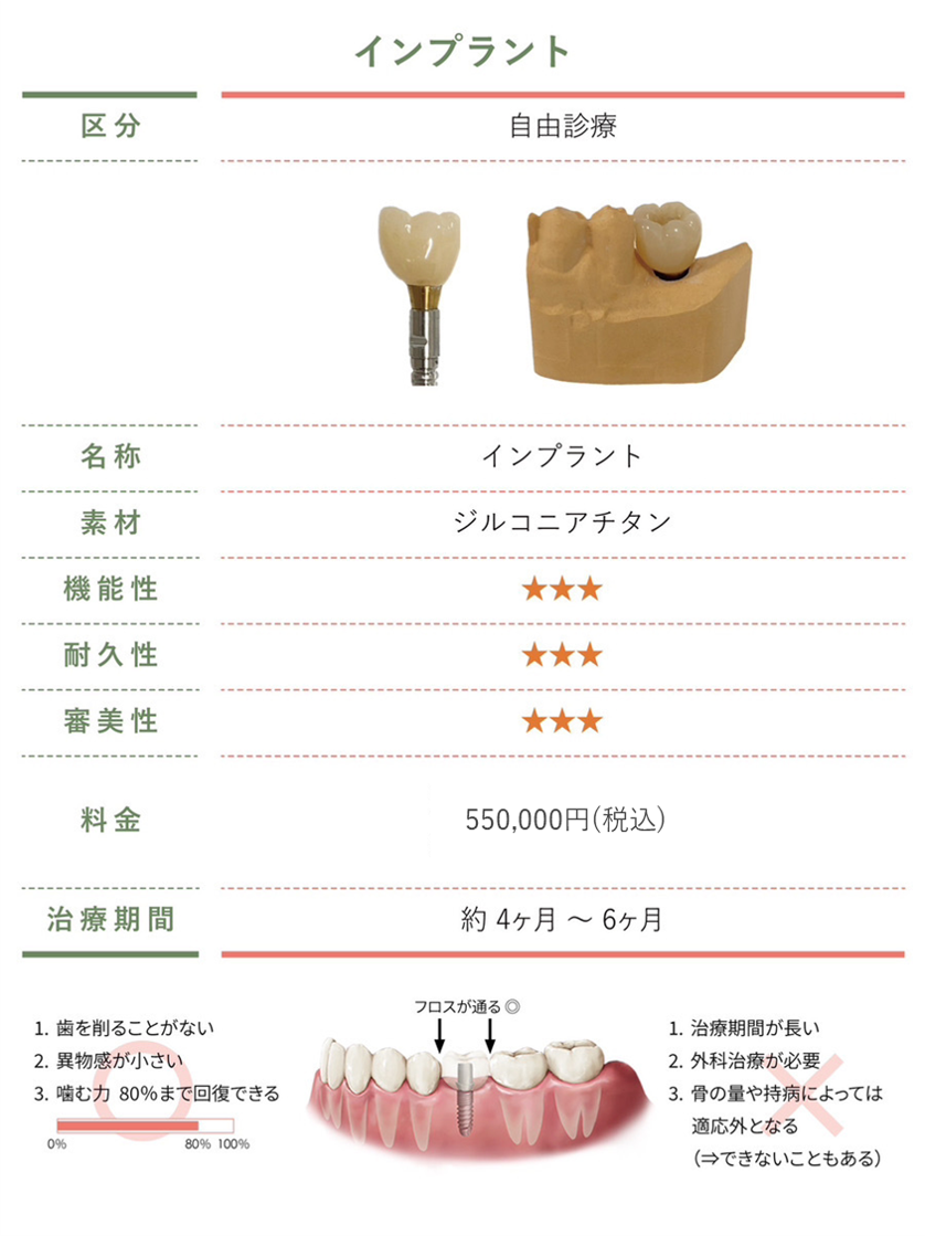 インプラント【料金変更】